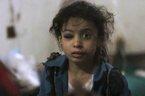 دختر بچه سوری در بیمارستان صحرایی حوالی شهر دوما (آتلانتیک)