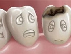 روش‌هایی برای تسکین درد دندان در سفرهای نوروزی/ توصیه‌هایی برای بهداشت دهان و دندان