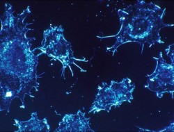 تصویربرداری از سلول‌های سرطانی ریه و استخوان با نانوحامل‌ها