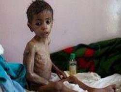 آمار وحشتناک سازمان ملل از محرومان یمنی