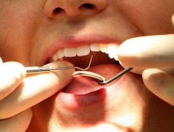 نکات مهم برای سلامت دهان و دندان‌