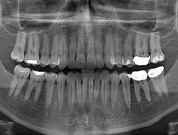 مشکل خدمات دندانپزشکی در شهرهای بزرگ/خلف وعده تأمین اجتماعی