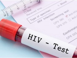 آخرین وضعیت HIV در ایران / نیمی از مبتلایان در سنین ۲۵ تا ۳۹ سال