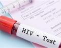 آخرین وضعیت HIV در ایران / نیمی از مبتلایان در سنین ۲۵ تا ۳۹ سال